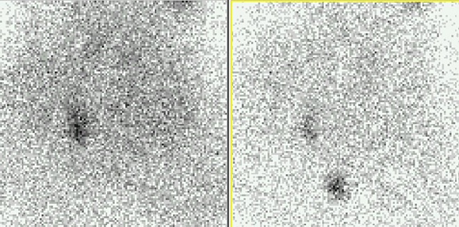 Obr. č. 2: 5 minutová statická scintigrafie pomocí kamery s kolimátorem pinhole 3 hodiny po aplikaci