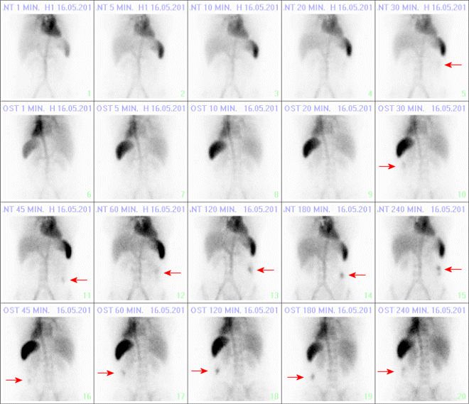 Obr. č. 1: Cílené snímky břicha vleže v 1., 5., 10., 20., 30., 60., 120., 180., 240. min. v přední i zadní projekci.