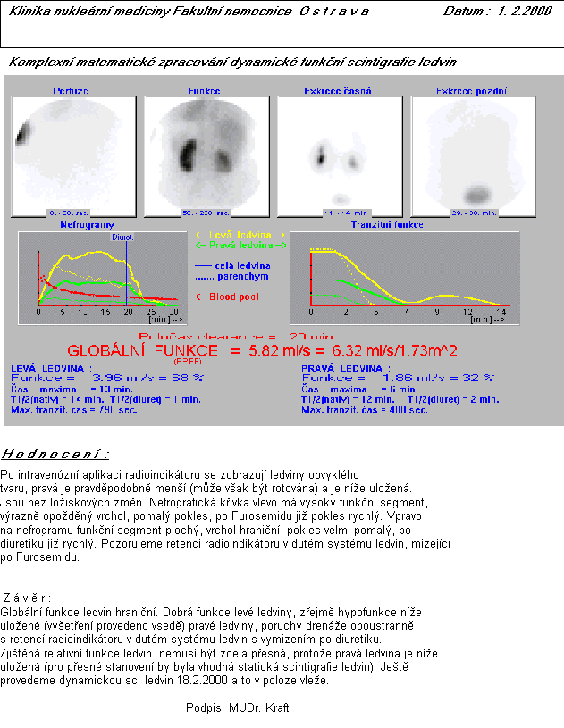 Rotop MAG3: dynamick scintigrafie ledvin
