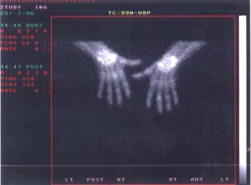 TechneScan HDP: clen zobrazen skeletu rukou