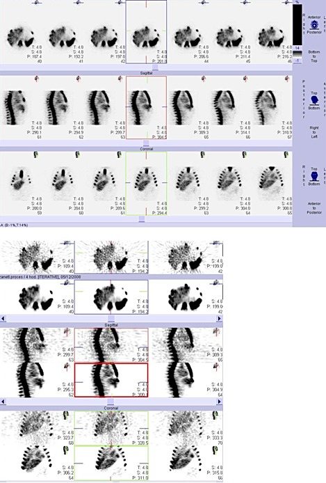 Obr. č. 9a, b: Tomografická scintigrafie (SPECT) břicha